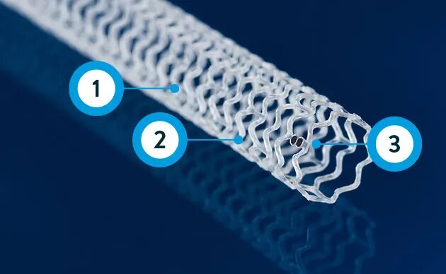 什么是外周支架雁过留声, 但它什么也没留下-外周可回收支架系统_https://www.jmylbn.com_新闻资讯_第34张