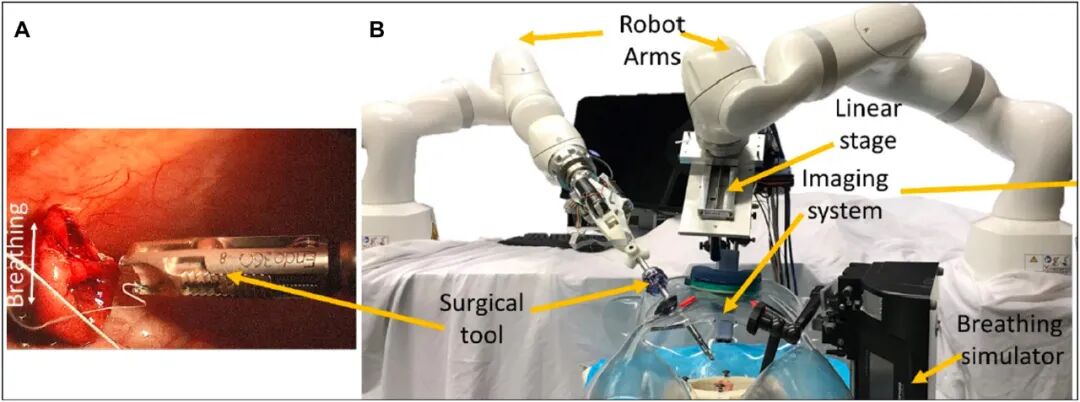 pta在医学上什么意思足背动脉旁路术：从技术革新到精准医疗_https://www.jmylbn.com_新闻资讯_第25张