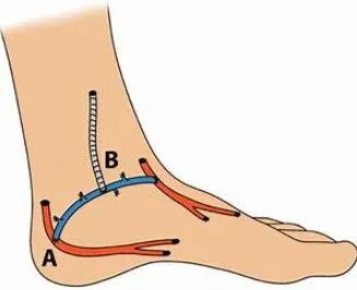 pta在医学上什么意思足背动脉旁路术：从技术革新到精准医疗_https://www.jmylbn.com_新闻资讯_第7张