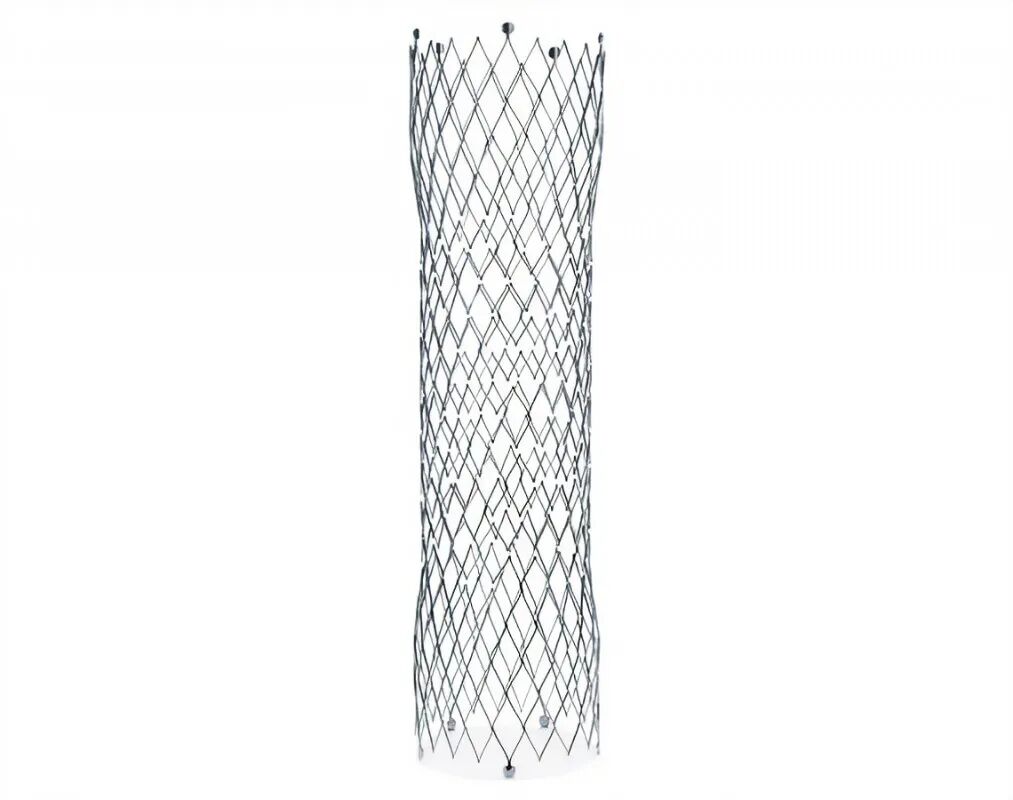 子宫支架是什么髂静脉支架能否耐受妊娠子宫？_https://www.jmylbn.com_新闻资讯_第13张