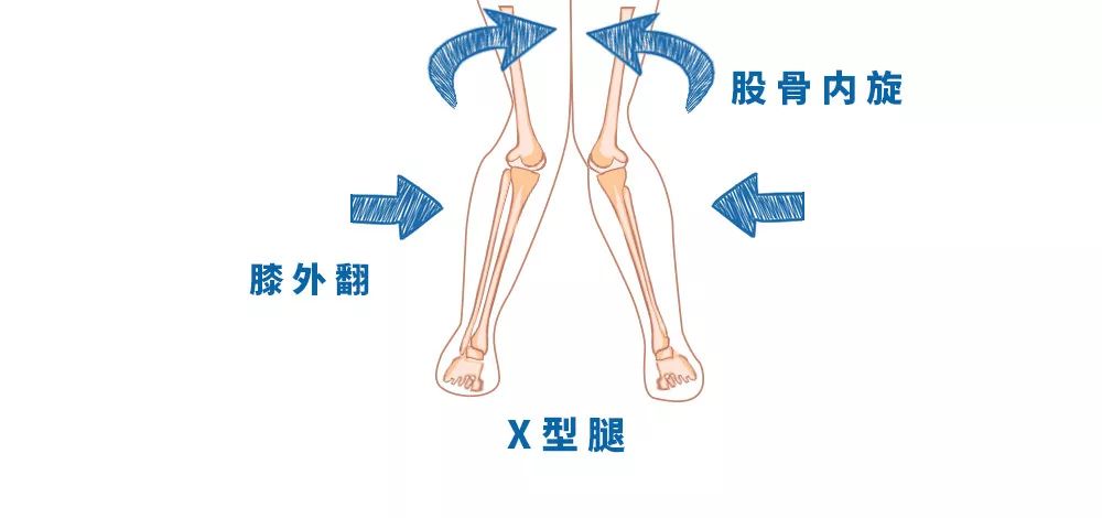 腿型测试 别让x型腿 O型腿毁了你 健力多天猫旗舰店