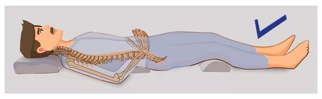 既然腰部悬空,骨盆前倾,我们可以在腰下垫一个小腰枕,承托住悬空的腰