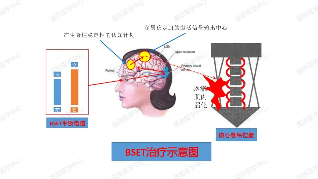 悬吊训练系统 怎么装2022【新品发布】颠覆性技术革新BSET生物反馈悬吊康复评估训练系统_https://www.jmylbn.com_新闻资讯_第3张