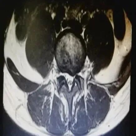 疼痛仪怎么回事快来看！激光磁场理疗仪疼痛的克星！_https://www.jmylbn.com_新闻资讯_第7张