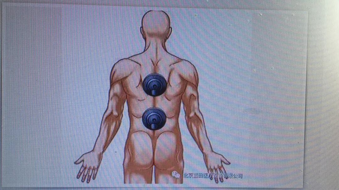 疼痛仪怎么回事快来看！激光磁场理疗仪疼痛的克星！_https://www.jmylbn.com_新闻资讯_第10张