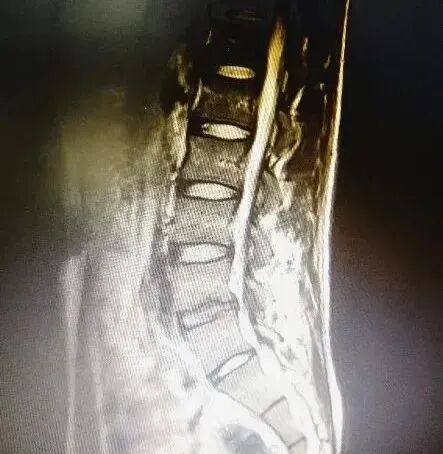 疼痛仪怎么回事快来看！激光磁场理疗仪疼痛的克星！_https://www.jmylbn.com_新闻资讯_第8张