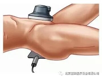 体外短波电容为什么要做短波治疗应用干货！康复科必读！_https://www.jmylbn.com_新闻资讯_第9张