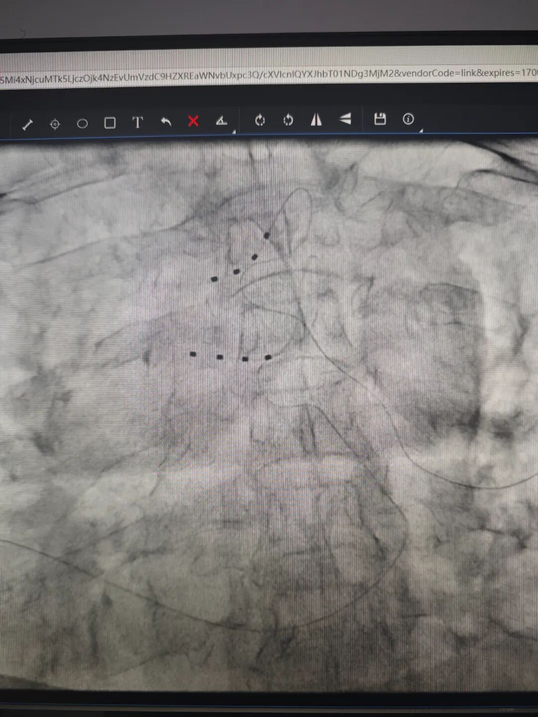 医疗电击器叫什么疼痛科用“电击疗法”治疗65岁阿姨“会呼吸的痛”_https://www.jmylbn.com_新闻资讯_第5张