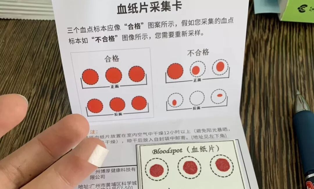 食物不耐受采样