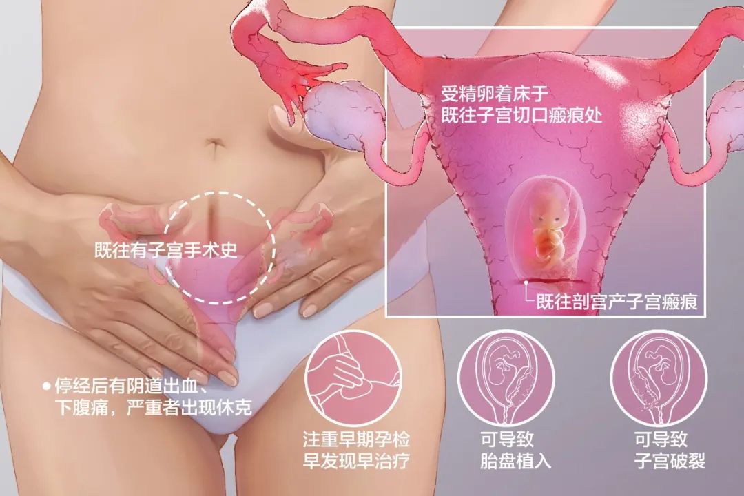 夏季备孕有捷径,别再“闷头造娃”啦!-微信头条网 夏季备孕有捷径,别再“闷头造娃”啦!
