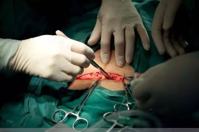 钦仰!生孩子怎么生"多多益善"-第1张图片-若克网