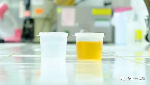 尿液什么价一公斤5元，高价回收孕妇“尿”！这到底是在做什么？_https://www.jmylbn.com_新闻资讯_第5张