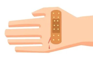 为什么电极能止血“世界急救日”，你会正确施救吗？_https://www.jmylbn.com_新闻资讯_第5张