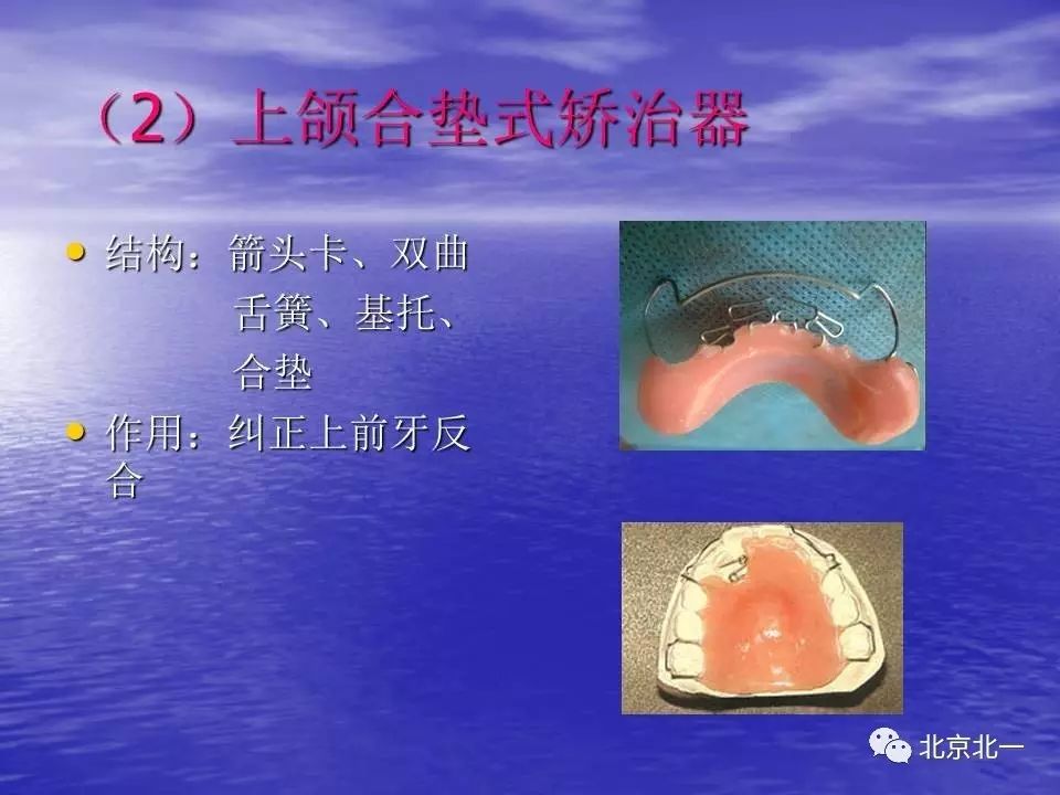 【南寧鼠標價格社區】【正畸】活動矯治器