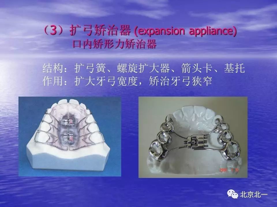 【南寧鼠標價格社區】【正畸】活動矯治器