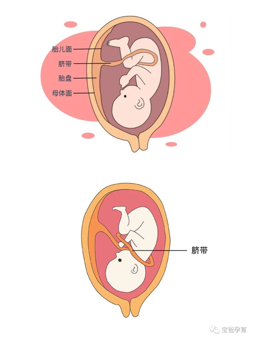 一次性脐带包怎么用怀孕不焦虑｜产检B超脐带异常一次性说清楚!_https://www.jmylbn.com_新闻资讯_第2张