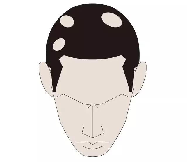 郭力話健康:失眠熬夜到底怎麼治? 健康 第8張-尋夢健康 郭力話健康:失眠熬夜到底怎麼治? 健康 第8張