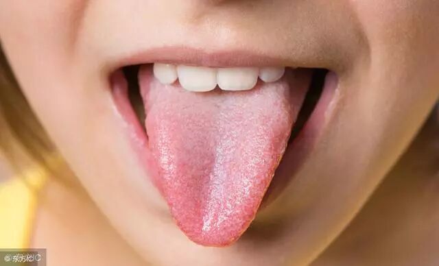 如何看舌辨病 中医教你对照这4种舌苔症状 调整饮食 健康秘密基地 微信公众号文章阅读 Wemp