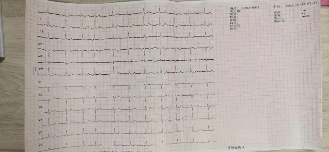 杭州顾连玺桥康复医院给脑出血昏迷昏迷的王太太做的检查诊断