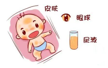 经皮胆红素怎么计算【妇幼微科普】黄疸宝宝日常监测方法之经皮测黄疸 VS 抽血查黄疸_https://www.jmylbn.com_新闻资讯_第2张