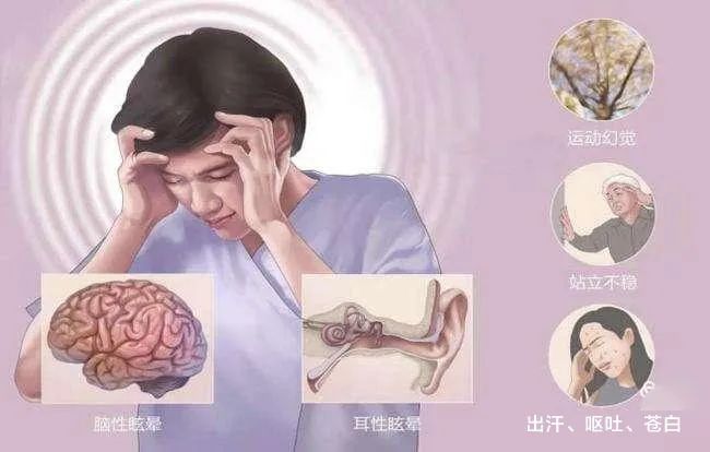 许昌市人民医院神经内一科—眩晕小知识