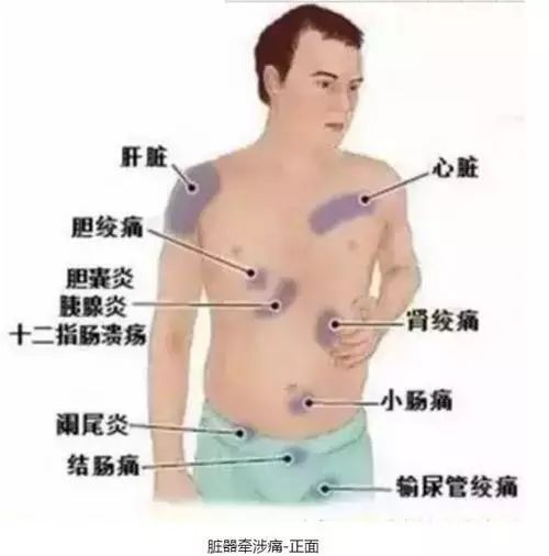 【医题】内脏痛知识问答