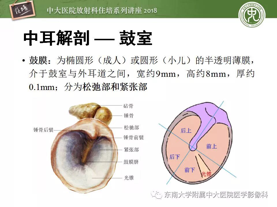 中耳解剖及中耳病变影像诊断 缤纷影像 微信公众号文章阅读 Wemp