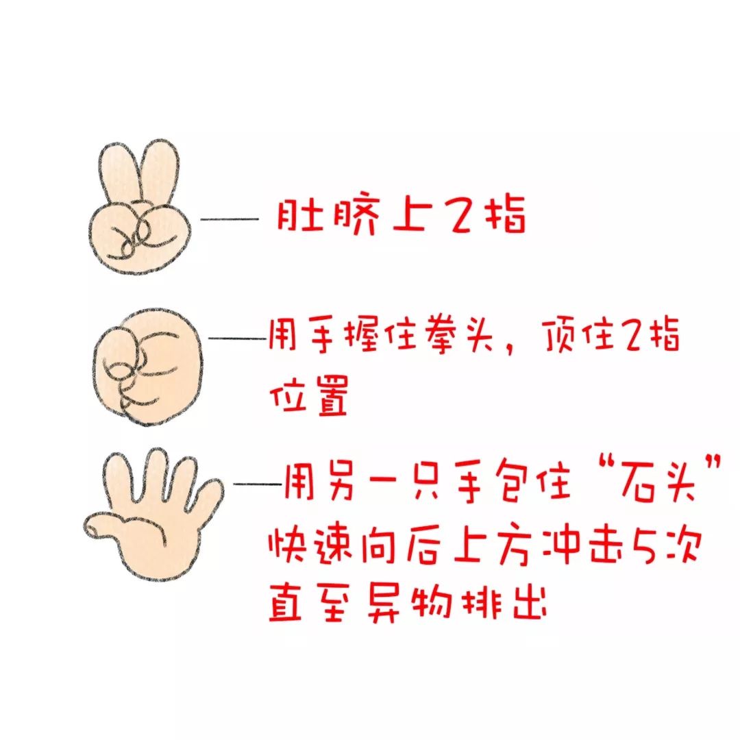 护士手绘海姆立克急救法转发可救人一命