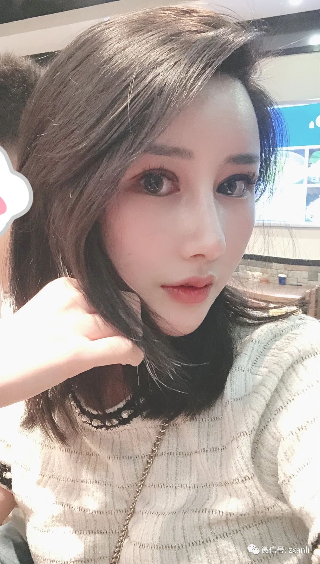 综合鼻子引流管在哪里鼻综合47天，跟大家分享我美美的鼻子_https://www.jmylbn.com_新闻资讯_第9张