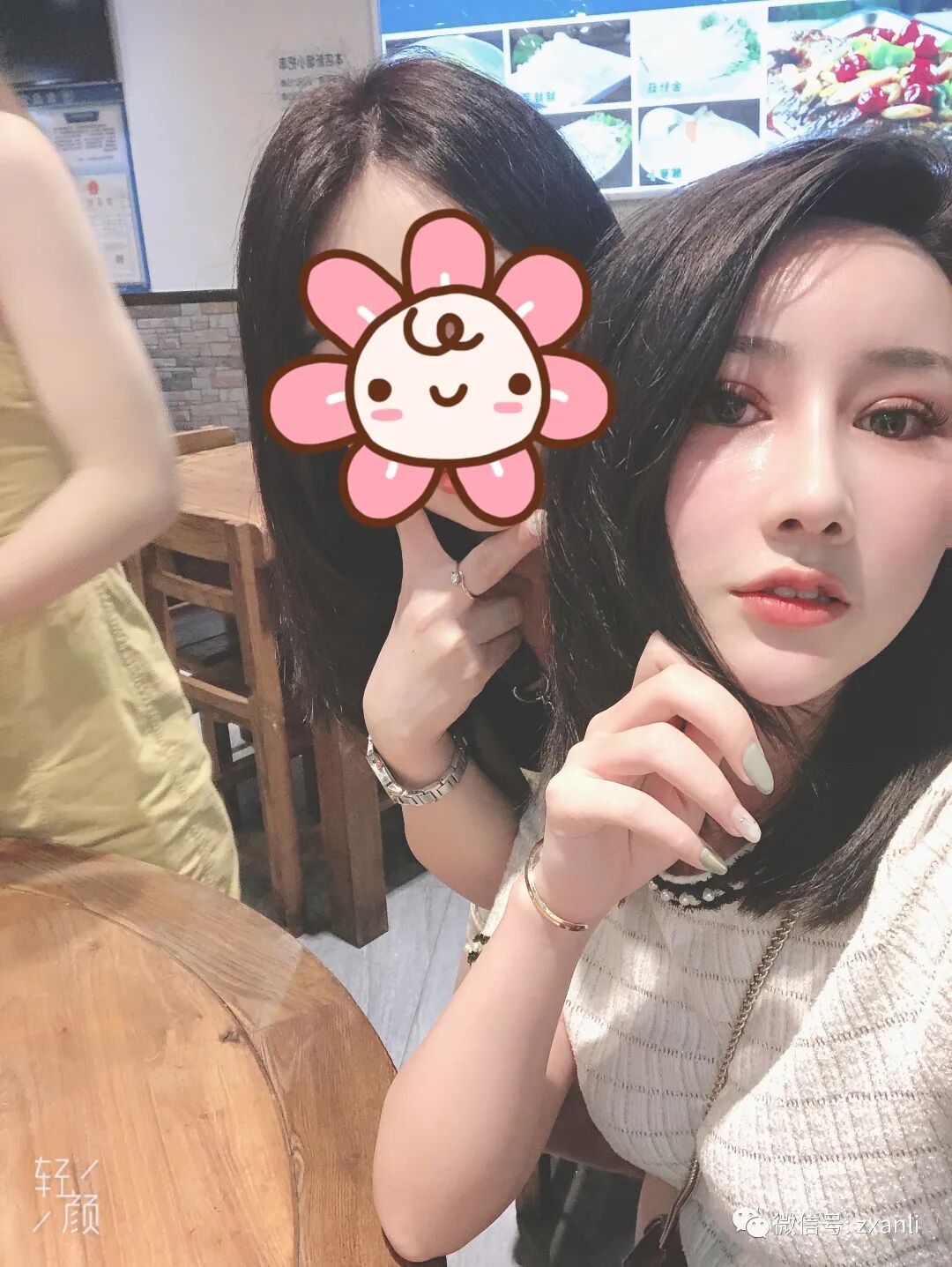 综合鼻子引流管在哪里鼻综合47天，跟大家分享我美美的鼻子_https://www.jmylbn.com_新闻资讯_第6张