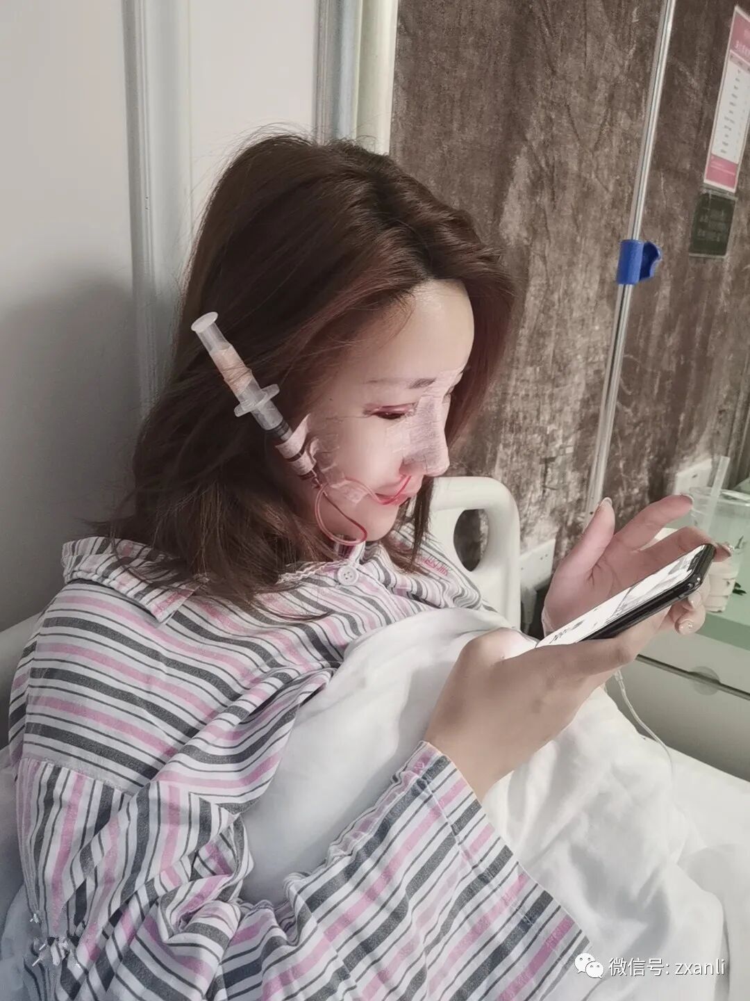 综合鼻子引流管在哪里鼻综合47天，跟大家分享我美美的鼻子_https://www.jmylbn.com_新闻资讯_第1张