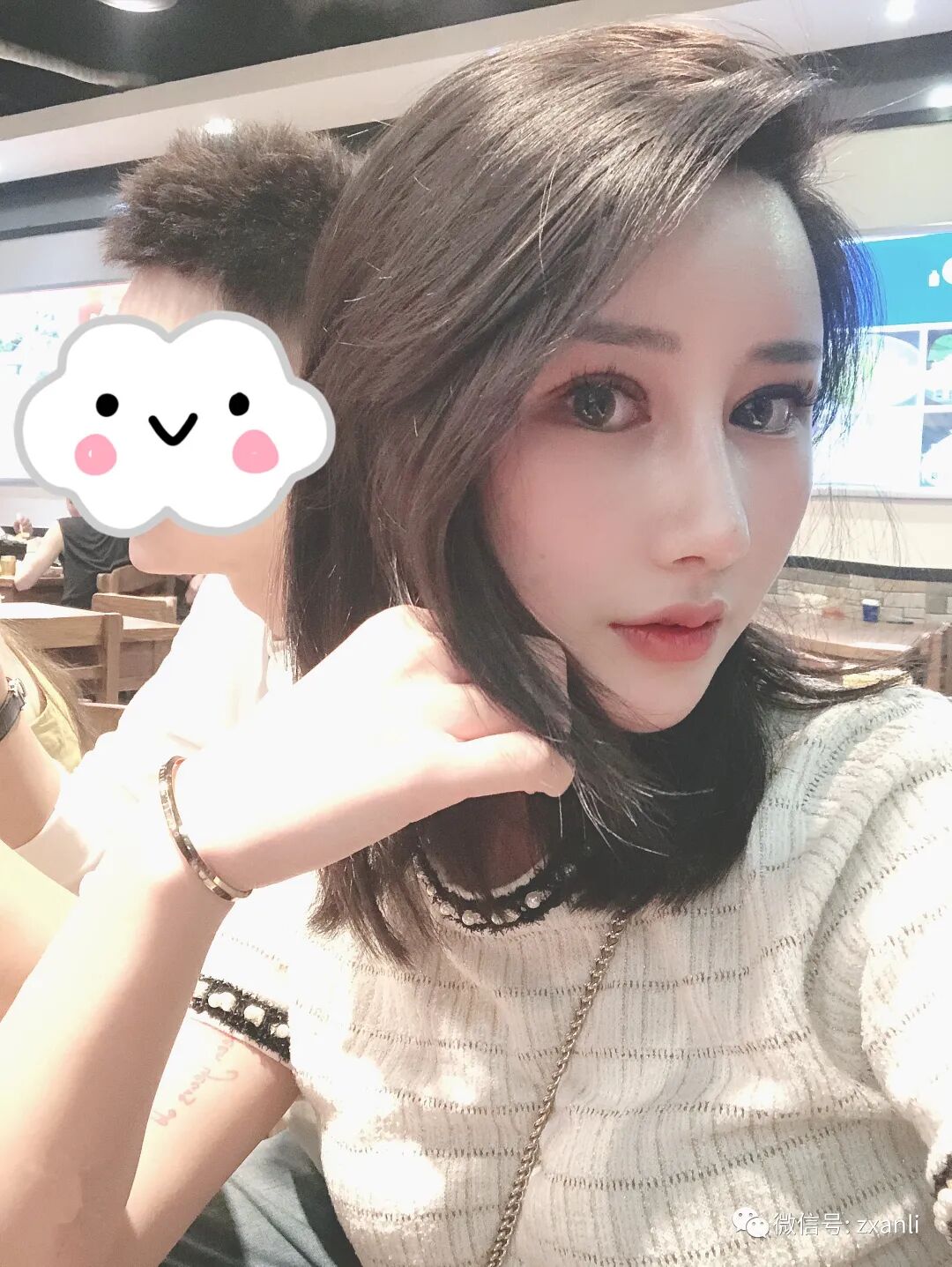 综合鼻子引流管在哪里鼻综合47天，跟大家分享我美美的鼻子_https://www.jmylbn.com_新闻资讯_第5张