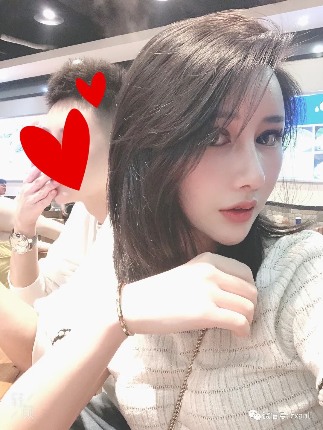 综合鼻子引流管在哪里鼻综合47天，跟大家分享我美美的鼻子_https://www.jmylbn.com_新闻资讯_第8张