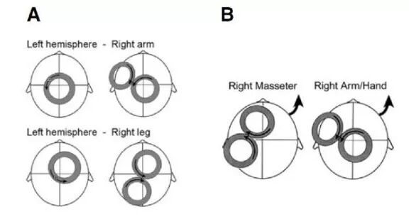 感觉阀值测量怎么测临床实践｜运动阈值我为什么总是测不出来？_https://www.jmylbn.com_新闻资讯_第6张