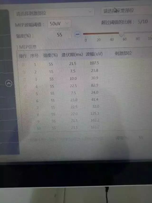 感觉阀值测量怎么测临床实践｜运动阈值我为什么总是测不出来？_https://www.jmylbn.com_新闻资讯_第11张