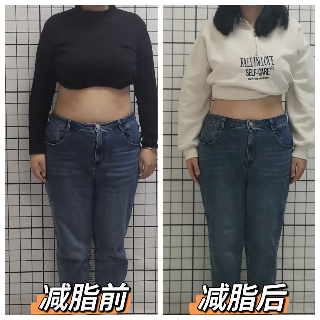 “神药”减肥后，停药遭遇反弹的你怎么办？