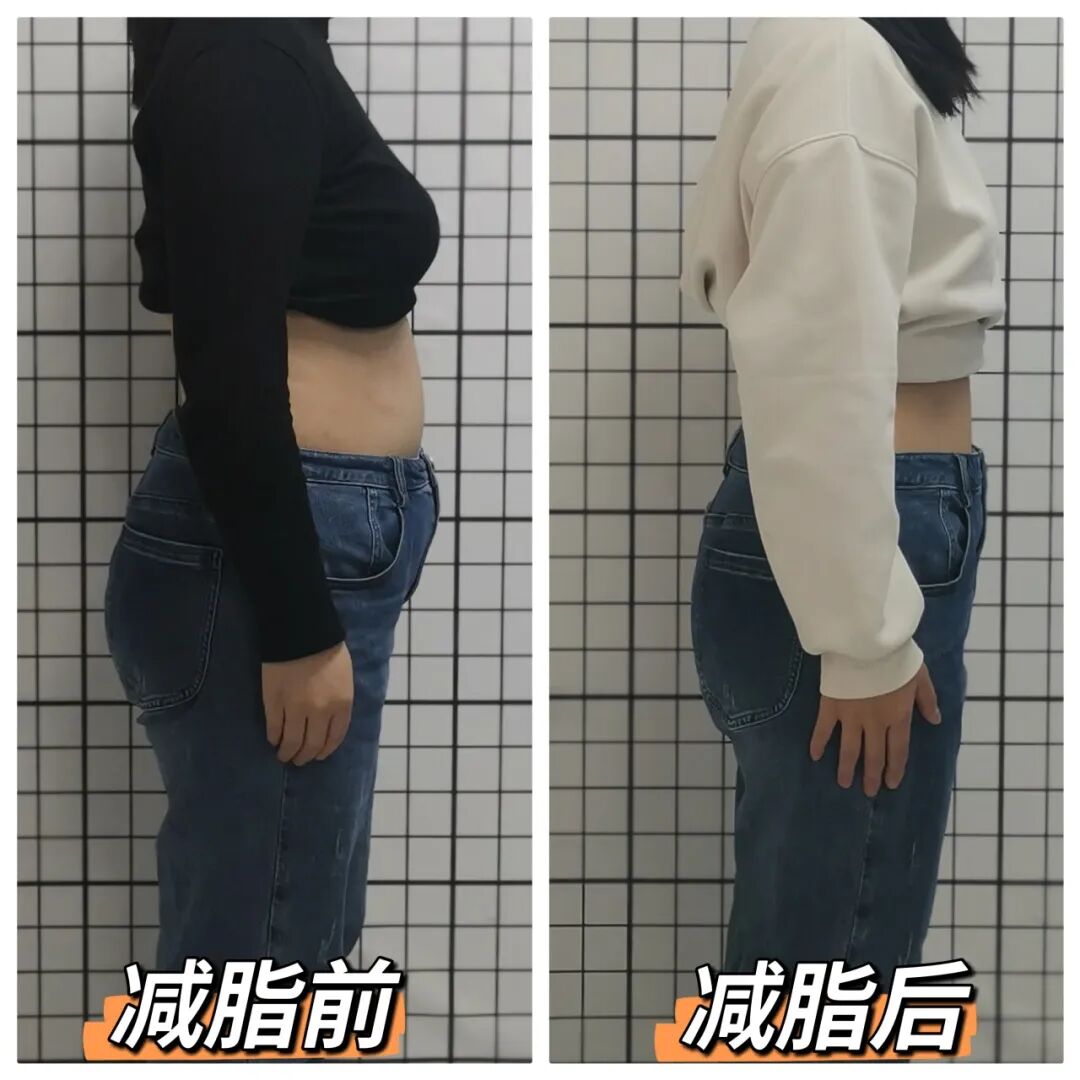 “神药”减肥后，停药遭遇反弹的你怎么办？