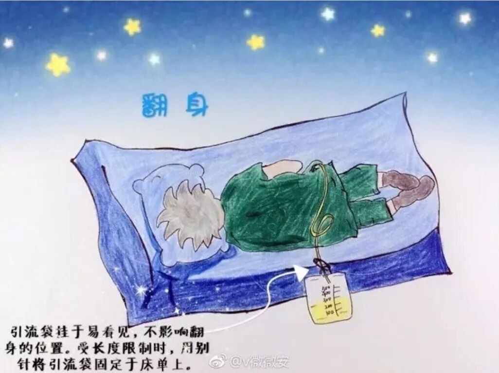 留置引流导管是什么浅谈留置导尿管_https://www.jmylbn.com_新闻资讯_第8张