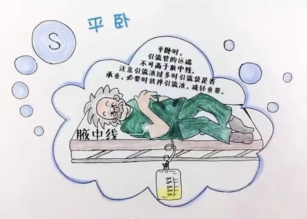 留置引流导管是什么浅谈留置导尿管_https://www.jmylbn.com_新闻资讯_第7张