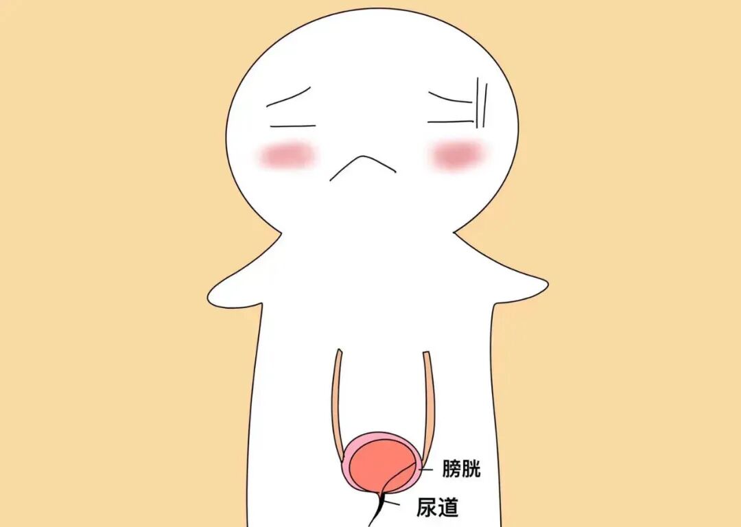 留置引流导管是什么浅谈留置导尿管_https://www.jmylbn.com_新闻资讯_第5张