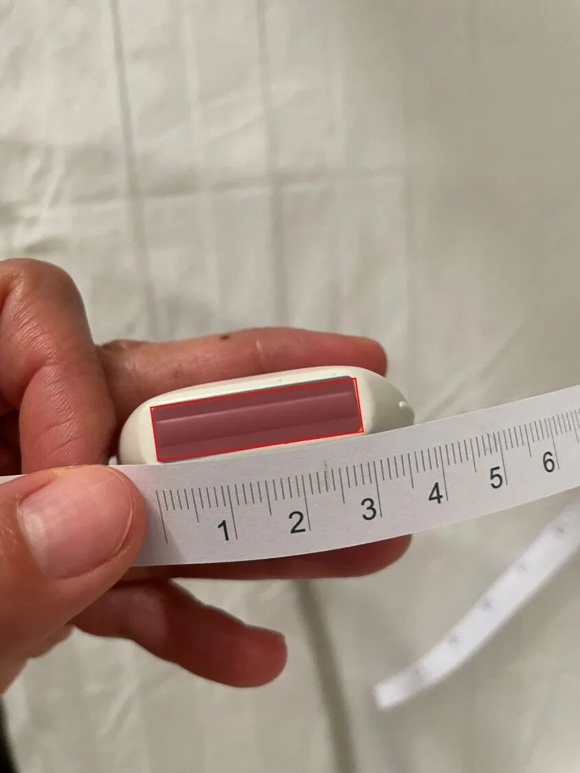 为什么20ml针筒的针在边上【静疗圈】超声引导下穿刺看不到针尖怎么办？_https://www.jmylbn.com_新闻资讯_第3张