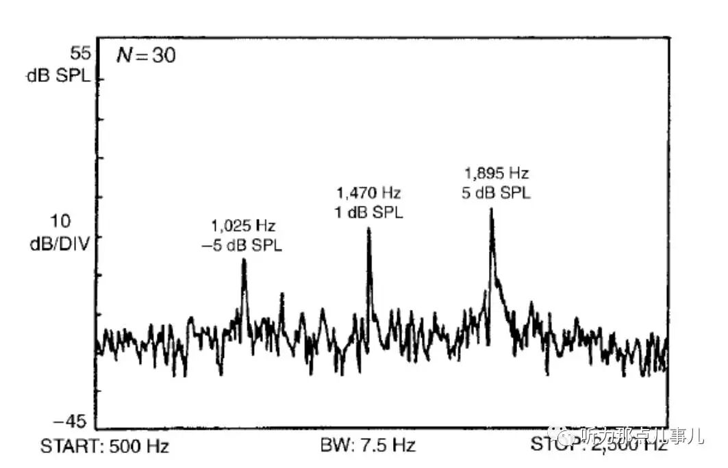 耳声发射图怎么看客观测听 ｜ 耳声发射_https://www.jmylbn.com_新闻资讯_第6张