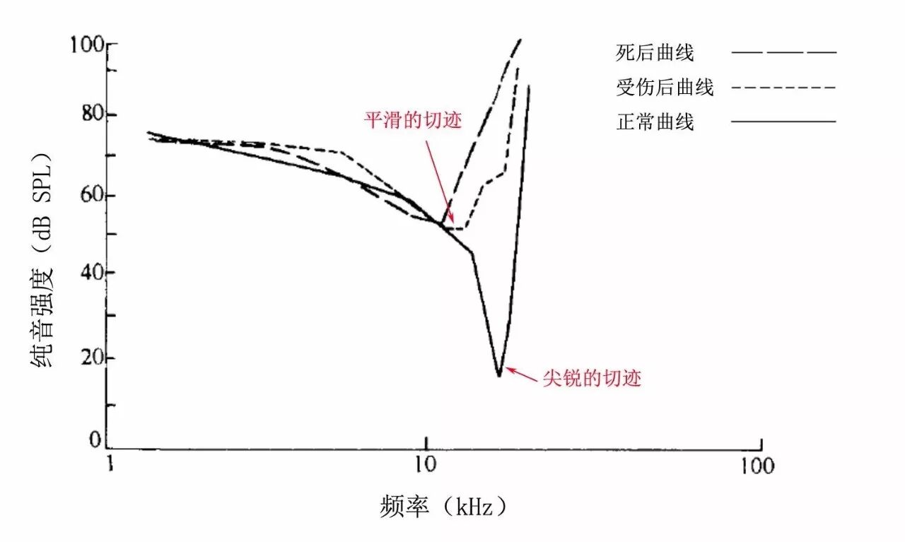 耳声发射图怎么看客观测听 ｜ 耳声发射_https://www.jmylbn.com_新闻资讯_第4张