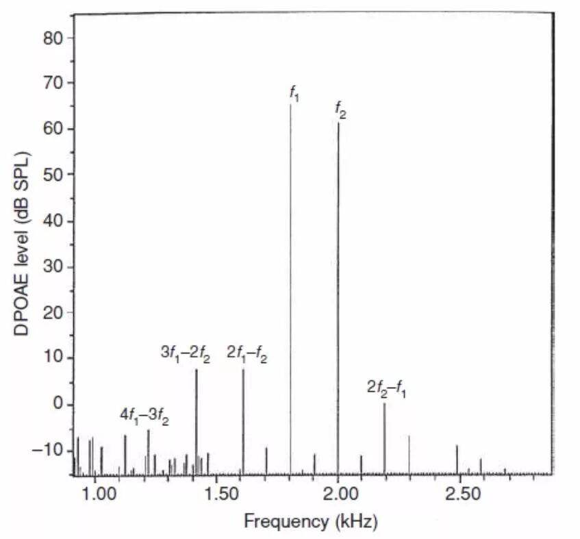 耳声发射图怎么看客观测听 ｜ 耳声发射_https://www.jmylbn.com_新闻资讯_第8张