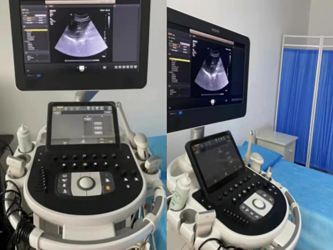 胎儿超声心电图是什么科室风采｜超声、心电图业务概况_https://www.jmylbn.com_新闻资讯_第4张