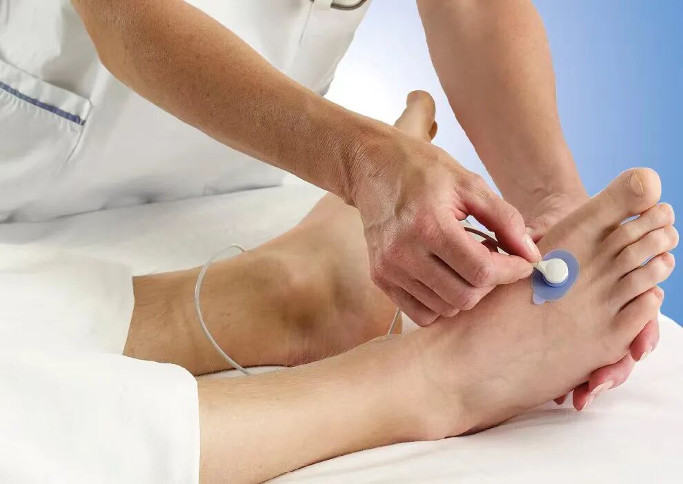 什么是经皮氧分压糖尿病足患者福音 ｜  内分泌科开展经皮氧分压监测新技术_https://www.jmylbn.com_新闻资讯_第11张