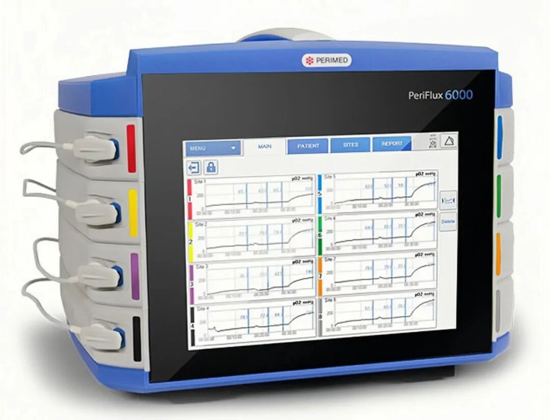 什么是经皮氧分压糖尿病足患者福音 ｜  内分泌科开展经皮氧分压监测新技术_https://www.jmylbn.com_新闻资讯_第5张