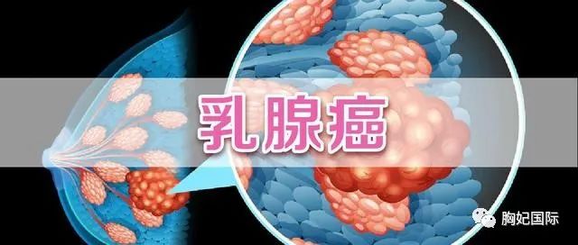 姚貝娜查出乳腺癌時是早期經過化療已經痊癒為啥人還是沒了