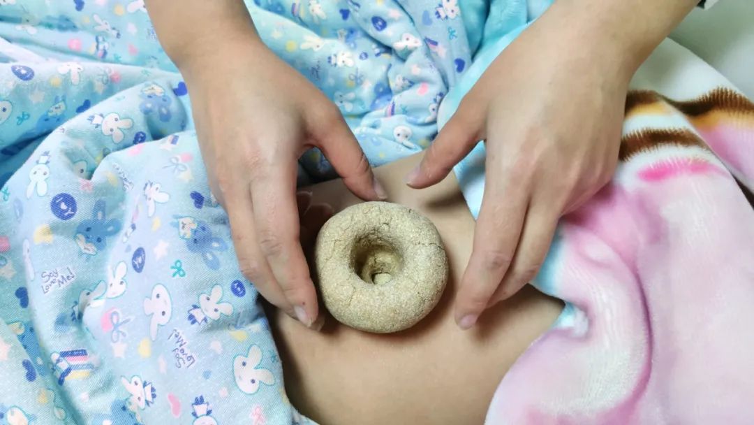 中医特色疗法有哪些