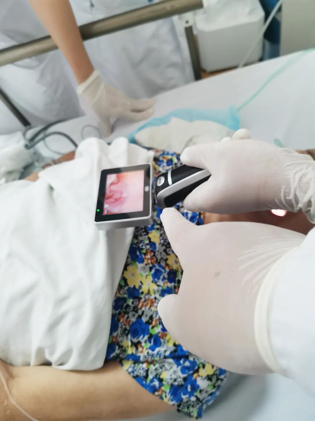 为什么购买可视硬性喉镜【内二科新技术】广东医科大学附属医院城月医院内二科护理团队开展可视喉镜下吸痰护理技术_https://www.jmylbn.com_新闻资讯_第11张